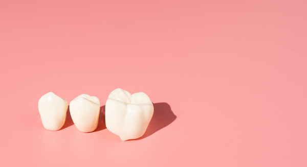 How To Take Care Of A Dental Crown