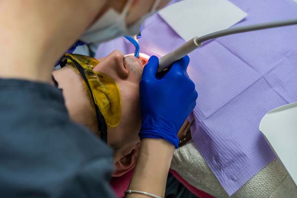 How A Dental Filling Is Used To Treat A Cavity