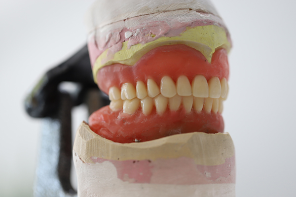 How Long Dentures May Last